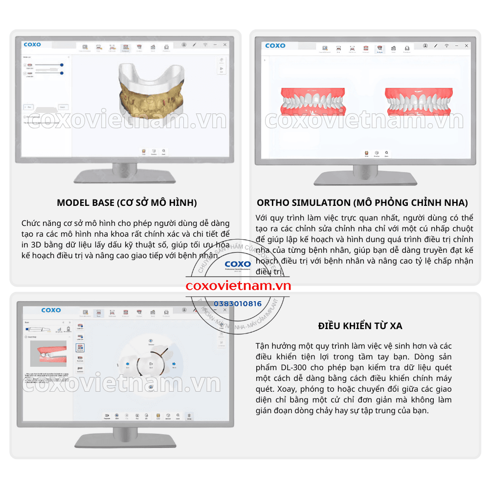 Máy scan trong miệng COXO DL-300P 11