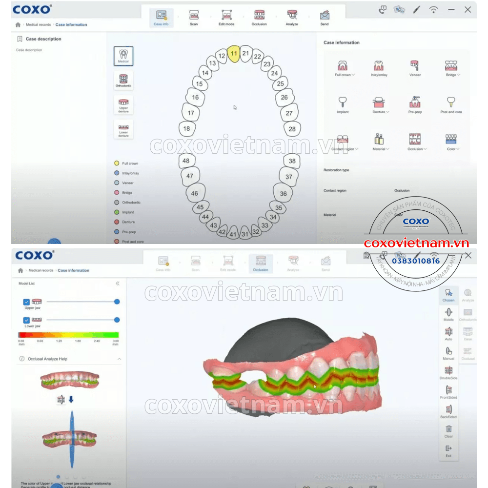 Máy scan trong miệng COXO DL-300P 7