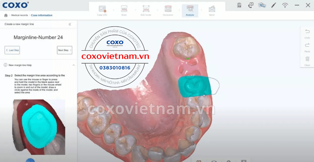 Máy scan trong miệng COXO DL-300P 8